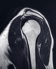 MR scan of elbow